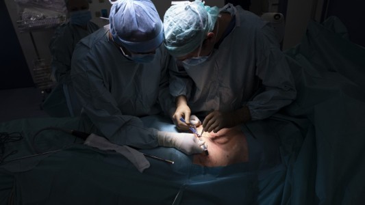 Sufre una grave enfermedad genética, lo operaron y le extrajeron un riñón de 7,4 kilos