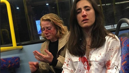 Video: así fue la brutal agresión a una azafata uruguaya y su novia en Londres