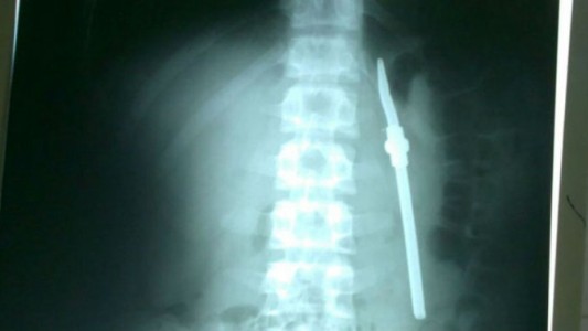 La historia del preso que tomaba mate y se tragó la bombilla