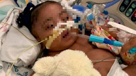 La lucha de una madre por mantener a su hija de 11 meses con vida: los médicos dicen que no hay esperanza de vida