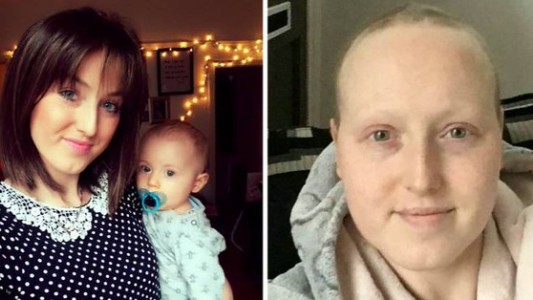 Habló la joven a la que le diagnosticaron cáncer por error: se tuvo que someter a quimioterapia y una masectomía