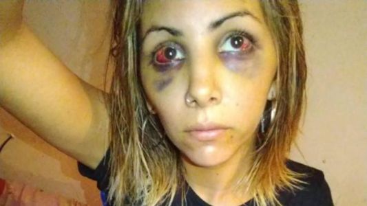 La advertencia de su ex tras desfigurarle la cara: "Agradecé que no te pegué un tiro"
