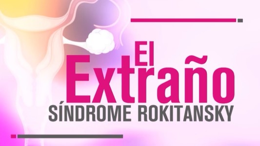 "El extraño síndrome Rokitansky"