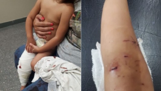 Un pitbull atacó a una beba, le dieron 40 puntos y no saben si caminará con normalidad