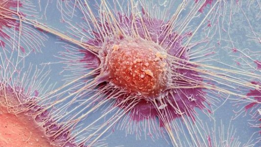 Un estudio del genoma del cáncer abre la posibilidad de detectarlo antes de que aparezca