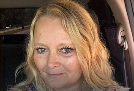 El calvario de una mujer tras un fallido tratamiento de cejas: "Me arruinó la cara"