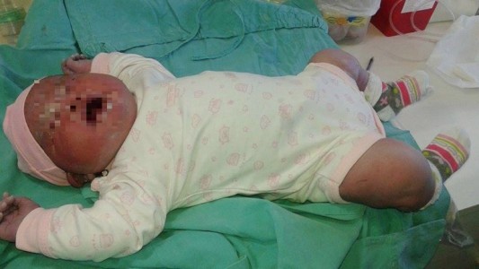 Nació una beba de más de seis kilos en Cipolletti