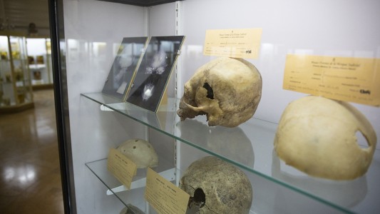 El museo que expone restos humanos