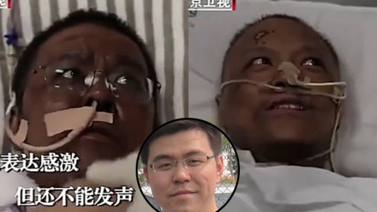 El sorpresivo cambio de color de piel de dos médicos que se recuperan de coronavirus en Wuhan