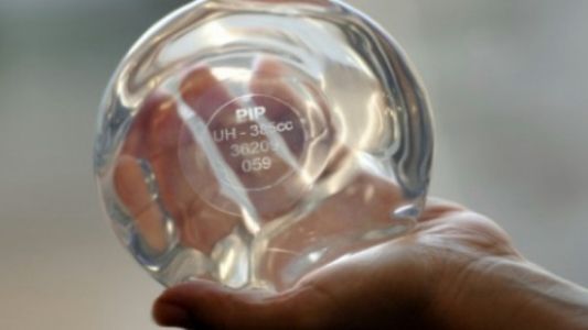 Francia indemnizará a 800 argentinas que recibieron implantes mamarios defectuosos