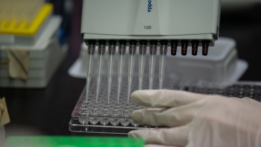 Laboratorio francés dará prioridad a EE.UU. cuando tenga vacuna contra el coronavirus