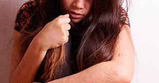 EE.UU. prohibió el uso de dispositivos eléctricos para tratar comportamientos autolesivos