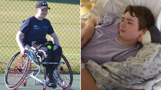 El joven que quedó paralítico por una infección causada por dos uñas encarnadas