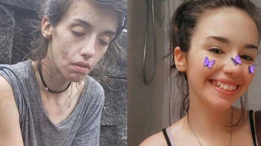 Una chica subió su foto "antes y después" para mostrar cómo se recuperó de la adicción a las drogas
