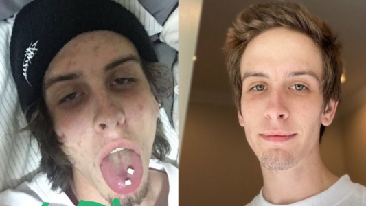 "Estoy vivo": el mensaje de un joven a 745 días de haber dejado las drogas