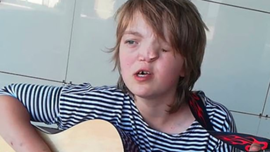 Su padre la abandonó porque nació con media cara: ahora lo busca en las redes para reencontrarse