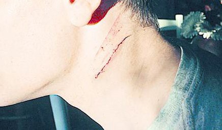 En una pelea de tránsito, un juez hirió a un joven