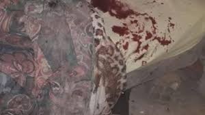 Le arrancó la oreja a su novia de un mordiscón