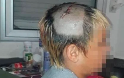 Dos policías le pegaron con la escopeta a un nene de 10 años y le fracturaron el cráneo