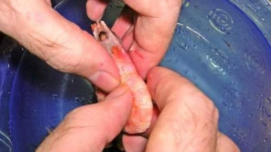 Se infectó con una bacteria "comecarne" cuando lavaba los mariscos