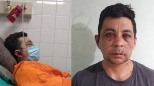 Tras recuperarse del coronavirus, vecinos golpearon a un enfermero, le quemaron la casa y le robaron el auto