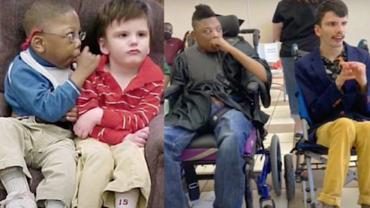 Cuando nacieron le dieron 2% de probabilidad de vida y ahora se sacaron una foto 18 años después