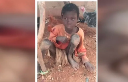 El nene que vivió dos años encadenado entre animales por tener epilepsia