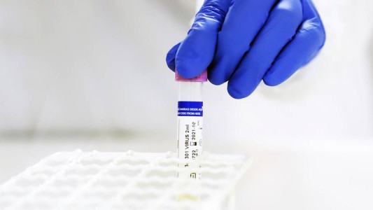 Científicos ven señales de "inmunidad duradera" tras una infección de coronavirus