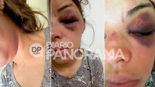 Una mujer se tuvo que tirar del auto de su ex pareja tras ser brutalmente golpeada