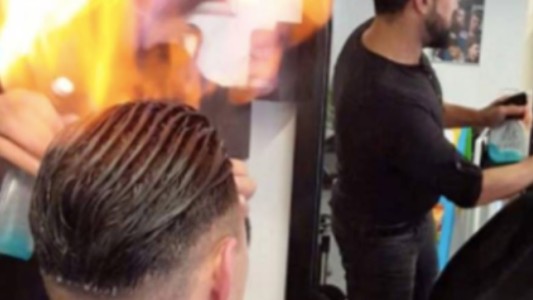 El peluquero decidió usar "técnica egipcia", prendió fuego el pelo del cliente y le provocó quemaduras