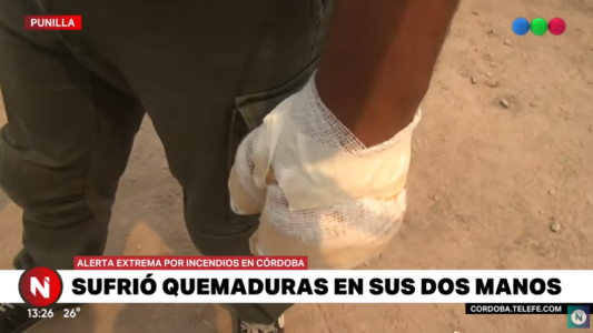 Se quemó las dos manos combatiendo los incendios forestales en Córdoba