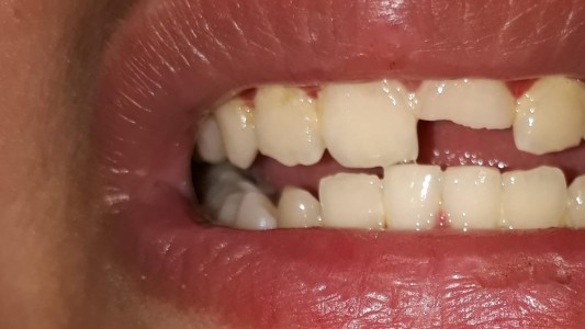 Un hombre golpeó a su hijo de 12 años y amenazó con tirarlo a las vías del tren