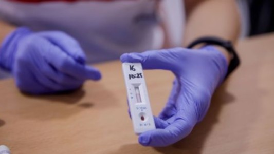 Lanzarán test de antígenos que permite diagnosticar el covid-19 en 18 minutos