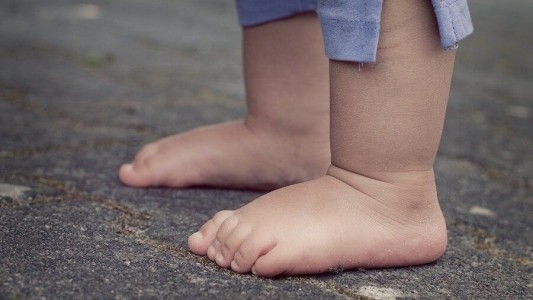Familiares de niños con acondroplasia buscan concientizar para "derribar prejuicios"