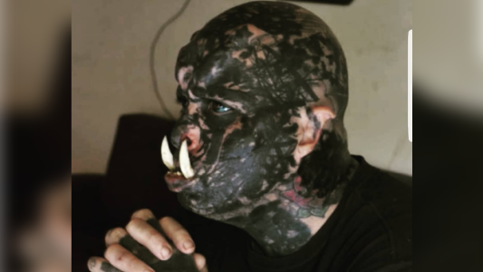 Video: el hombre que se puso colmillos para parecer un orco