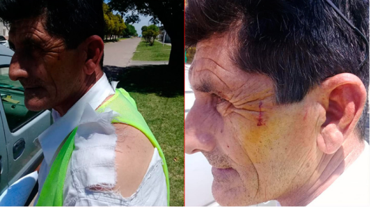 Agredió a inspector que lo notificó para que use barbijo dentro de los comercios