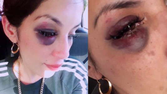 Video: Romina denunció a su expareja porque la molió a golpes y sigue libre