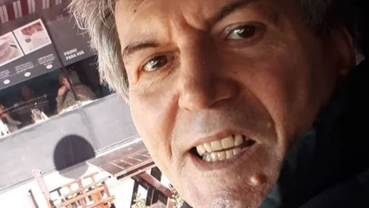 El actor Carlín Calvo fue derivado a un centro de cuidados especiales