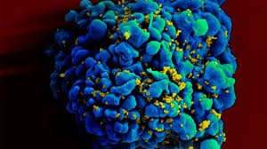 Alarma por el virus Chapare identificado en Bolivia: es similar al ébola