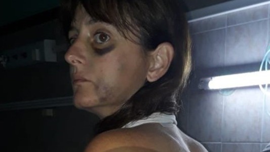 Le dio una terrible paliza a su pareja y la Justicia lo dejó en libertad