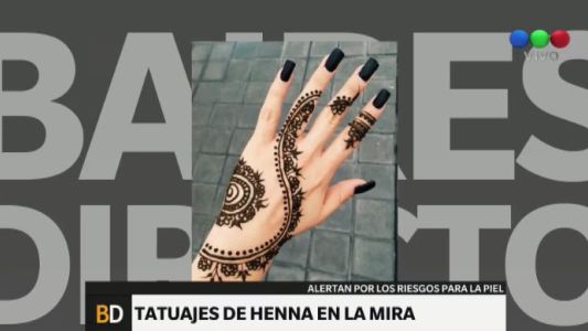 Los tatuajes de henna también pueden ser peligrosos