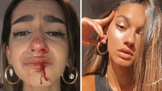 Una influencer trans sufrió una brutal golpiza en la calle