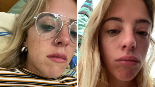 Nati Jota pidió disculpas por sus tuits racistas: "Quería sumar seguidores"