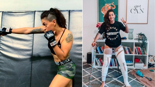 Luchadora de MMA sufrió graves quemaduras en sesión de crioterapia y casi pierde las piernas