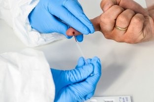 El sitio internacional Our World in Data vuelve a utilizar datos argentinos sobre el coronavirus