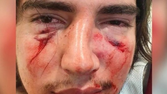 Córdoba: agravan la imputación contra los rugbiers por la golpiza