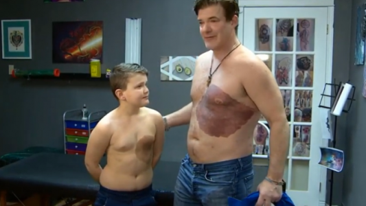 Video: el papá que se tatuó la mancha de nacimiento de su hijo para "hacerlo sentir bien"