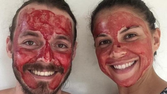 La pareja que usa sangre de la menstruación para mejorar la piel de la cara