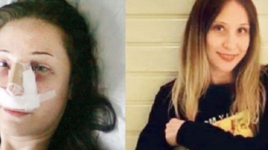 Fue al hospital para una cirugía estética en la nariz y terminó con las piernas amputadas