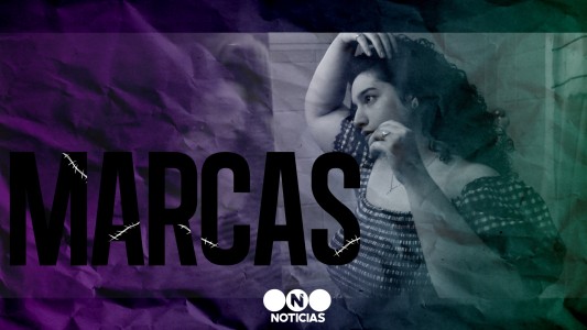 Agustina Cabaleiro: la influencer que aprendió a querer sus estrías